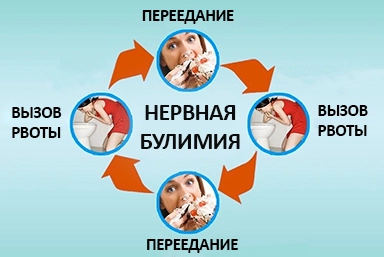 Лечение булимии в Новониколаевском